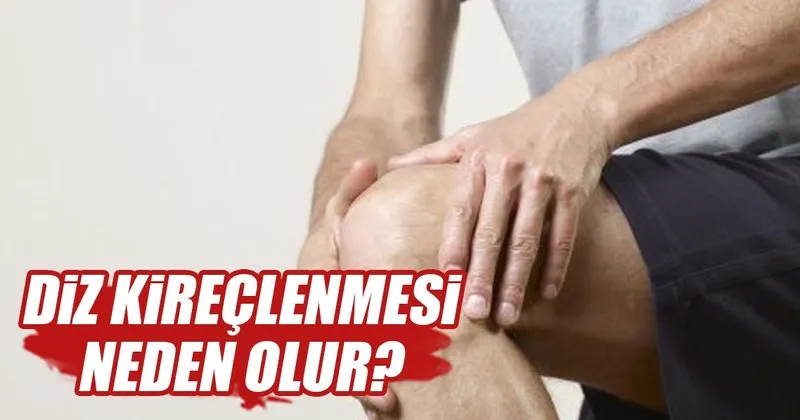 diz kireclenmesi nasil tedavi edilir
