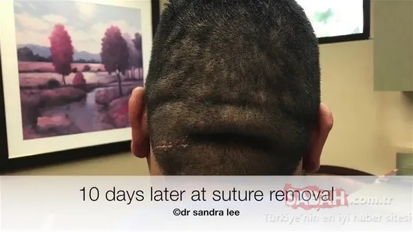 Doktora bu halde geldi! Sonrasındaysa...