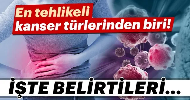 pankreas kanseri belirtileri nelerdir