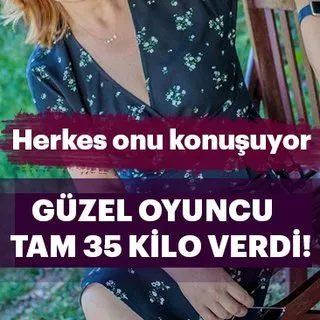 Herkes Özlem Türkad’ı konuşuyor! Güzel oyuncu tam 35 kilo verdi