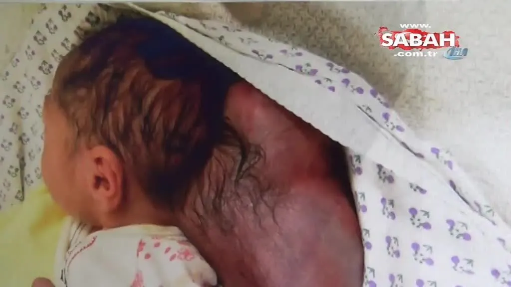 Hatay Da Iki Kafali Bebek Dunyaya Geldi Videosunu Izle Son Dakika Haberleri