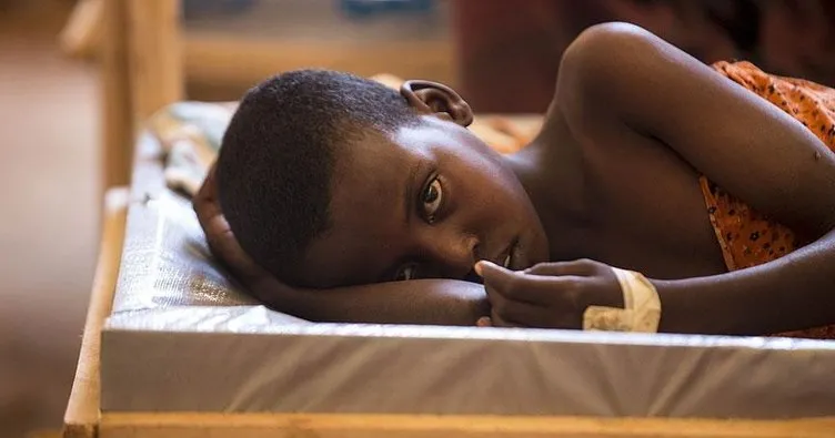 Çad’da kolera salgını: 120 ölü