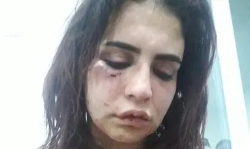 ruyada dayak yedigini gormek ne anlama gelir haberleri son dakika ruyada dayak yedigini gormek ne anlama gelir gelismeleri