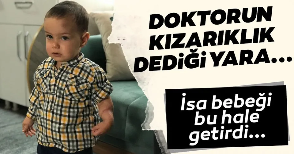 isa bebegin vucudundaki esrarengiz yara