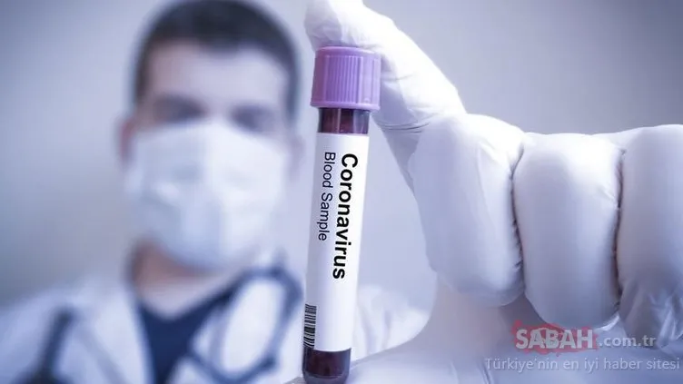 Dünyaca ünlü Fransız ilaç laboratuvarından son dakika haberi: ’Plaquenil ilacı corona virüsü tedavisi için test edilecek’