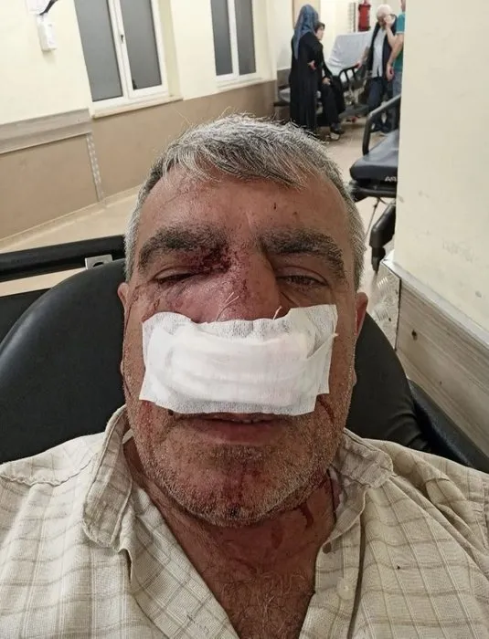 İstanbul’da taksici dehşeti! Yumrukladı burnunu kırıp kaçtı: O anlar kamerada...