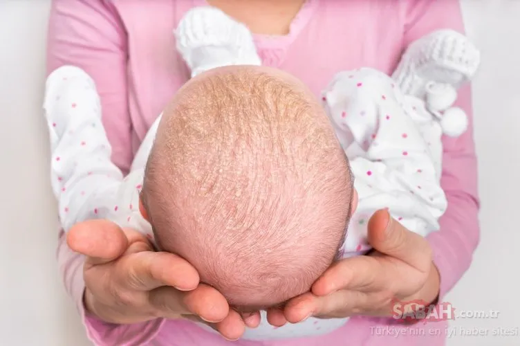 Saç bakımı bebeklerde nasıl yapılır?