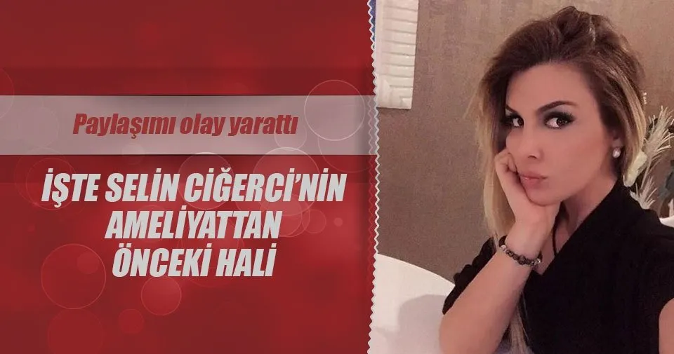 selin cigerci ameliyattan onceki halini paylasti son dakika magazin haberleri