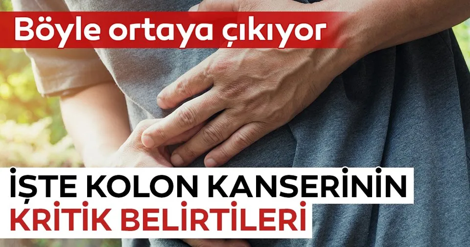 kolon kanseri belirtileri nelerdir