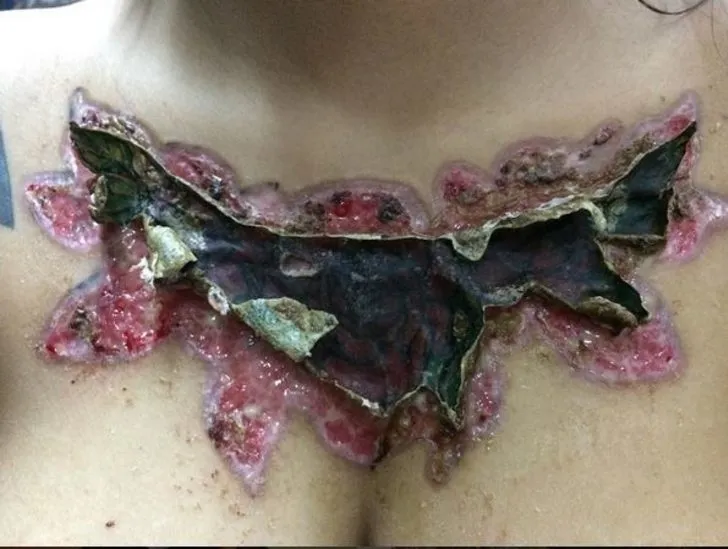 Dövme yaptırdılar sonucu bakın ne oldu!