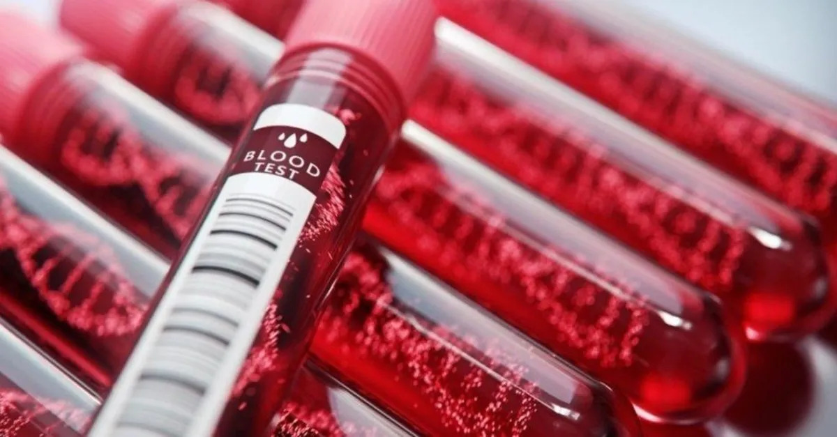 hgb hemoglobin degeri nedir hgb dusuklugu ve yuksekligi ne anlama gelir normal hgb degerleri kac olmali saglik haberleri