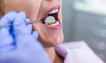 Diş araları nasıl temizlenir? Diş temizleme ve beyazlatma önerileri