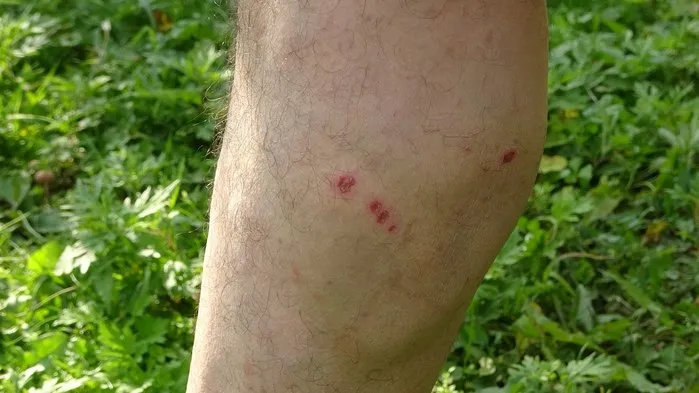 Sokak köpekleri dehşeti yaşattı: Hüsnü Kabataş bacaklarından yaralandı!