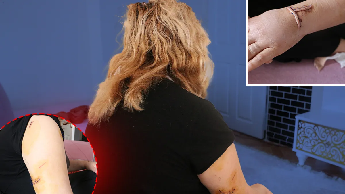 Diyarbakır’da nikahlı eşini 30 yerinden bıçaklamıştı! Talihsiz kadın dehşete düşüren anları anlattı: Sırtımdan defalarca kez bıçaklayıp… Diyarbakır’da nikahlı eşini 30 yerinden bıçaklamıştı! Talihsiz kadın dehşete düşüren anları anlattı: Sırtımdan defalarca kez bıçaklayıp…