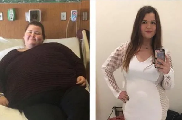 100 kilo verdi şimdi görenler güzelliğine hayran kalıyor!