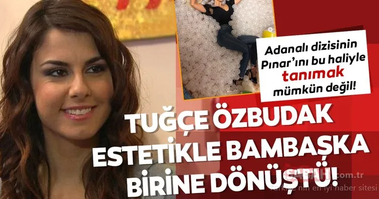 Tuğçe Özbudak estetikle bambaşka birine dönüştü! Adanalı dizisinin Pınar’ını bu haliyle tanımak mümkün değil!