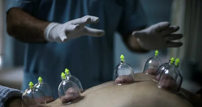 hacamat nedir hacamat nasil yapilir