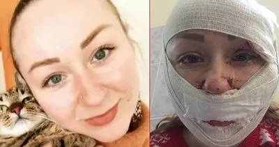 Ukraynalı Anna Butim’i falçatayla yaralamıştı: Cani koca hakkında istenen ceza belli oldu!
