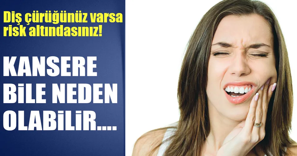 Diş çürüğü kanser yapar mı? Sağlık Haberleri