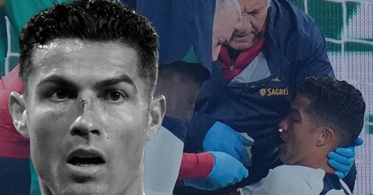 Son dakika haberleri: Kanlar içinde yerde kalmıştı... Ronaldo’nun son hali şaşkına çevirdi!
