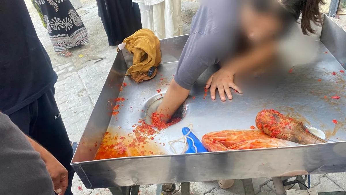 Şanlıurfa’da talihsiz olay: 16 yaşındaki kız elini makineye kaptırdı! Şanlıurfa’da talihsiz olay: 16 yaşındaki kız elini makineye kaptırdı!