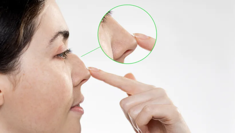 BURUN UCU NEDEN DÜŞER?