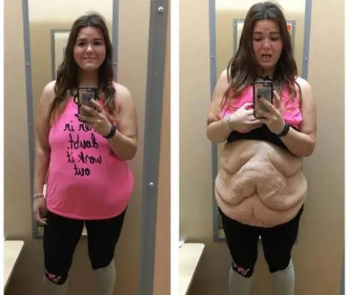 100 kilo verdi şimdi görenler güzelliğine hayran kalıyor!