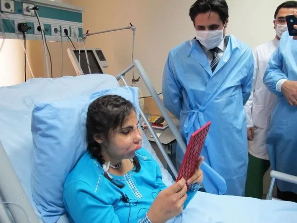 Hatice Nergis yeni yüzünü ilk kez gördü