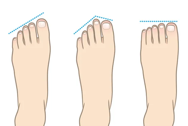 Ayak şekliniz kişiliğinizi ele veriyor! Doğuştan lider olan o kişiler…