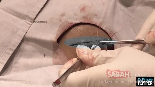 Doktora bu halde geldi! Sonrasındaysa...