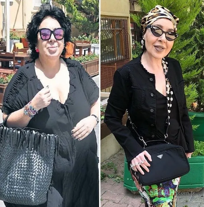 Hayatını kaybeden Nur Yerlitaş kanserin son evresindeydi... Nur Yerlitaş son hali ile sevenlerini üzmüştü...
