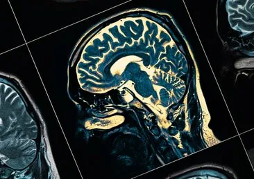 Yeni jenerasyon bilgisayar arayüz sistemi, beyinde yeni tedavilerin önünü açabilir