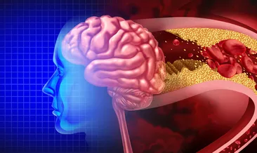 İnmede ilk 4.5 saat çok kritik! Özellikle bu yaş aralığına dikkat...