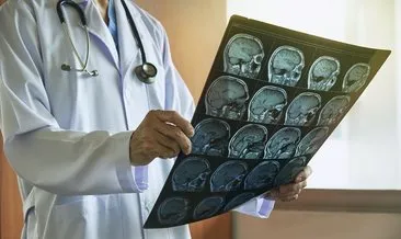 Beyin Cerrahi Neye Bakar? Beyin Ve Sinir Cerrahi Bölümü Nedir, Beyin Ve Sinir Cerrahi Hangi Hastalıklara Bakar ve Hangi Testleri Yapar?