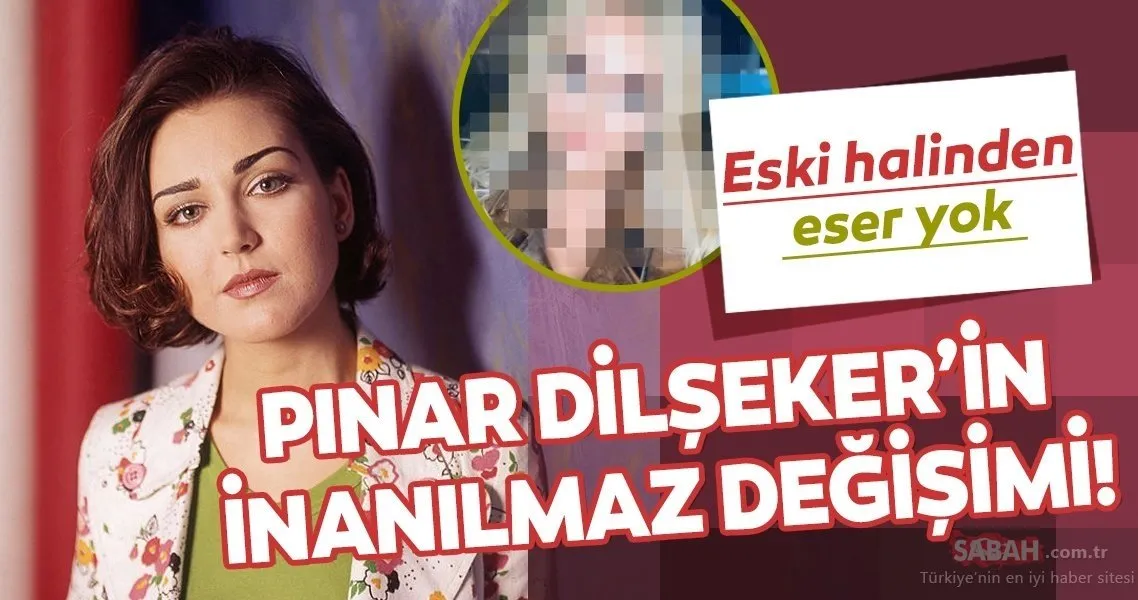 Pınar Dilşeker estetiğin dozunu kaçırdı! Onu tanıyabilmek artık çok zor