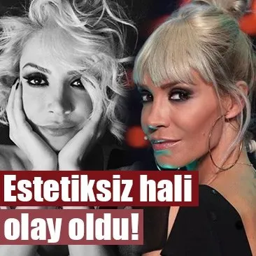 Iste Oyku Serter In Estetiksiz Hali Sanal Basin