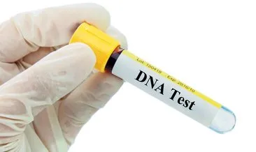 186 milyon TL’lik DNA testi