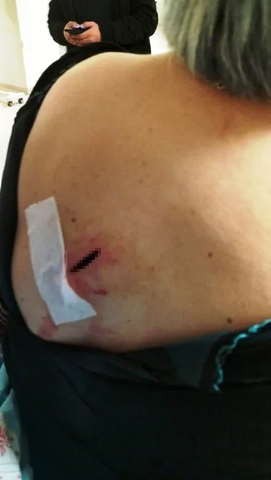 Genç kadın kabusu yaşadı! Yolda yürürken sırtından bıçaklandı