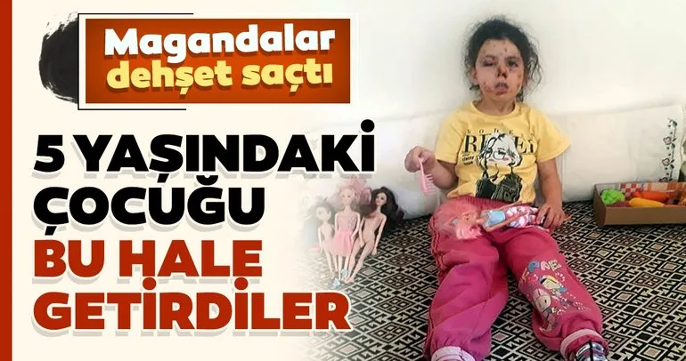 Son dakika: İzmir’de korkunç olay! 5 yaşındaki Neriman Bulut’u bu hale getirdiler!
