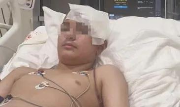 Akran şiddeti komalık etti