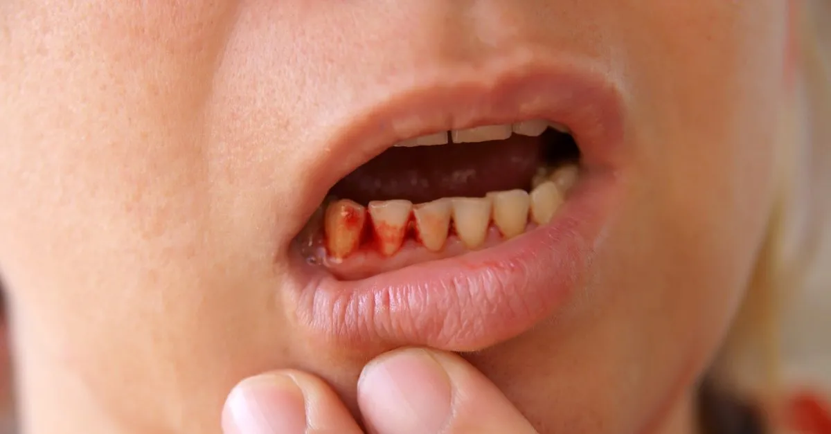 c vitamini eksikligi belirtileri