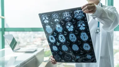 Yapılan bu hata beyni 20 yıl birden yaşlandırıyor! Alzheimer ilk sinyallerini 30’lu yaşlarda veriyor...