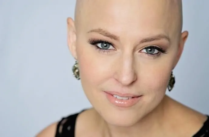 Kemoterapi tedavisinde dökülen saçlara hiç üzülmeyin!