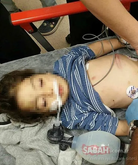 SON DAKİKA! 3 yaşındaki kızın üzerine motosiklet düştü diye hastaneye kaldırdılar! Kan donduran gerçek ortaya çıktı