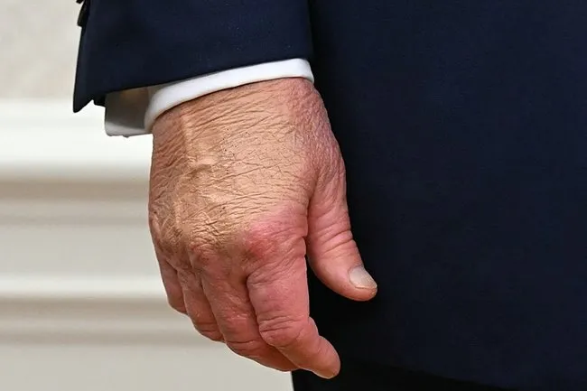 SON DAKİKA… ABD Başkanı Donald Trump’ın sağlık durumu nasıl? Doktoru açıkladı: Olağanüstü derecede…