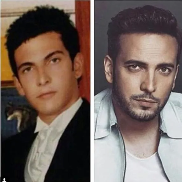 Ünlülerin değişimleri (Küçük Onur)