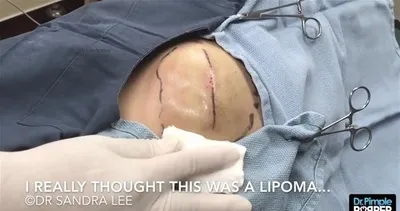 Doktor gördükleriyle şoka uğradı! Genç kadının kalçasından çıkardılar...