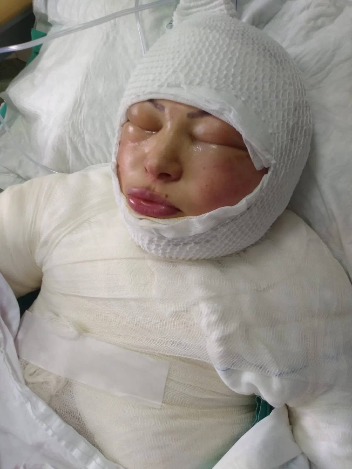 Son dakika: Ordu'da korkunç olay! Eşini ateşe verdi! Oturup yanmasını  izledi - Galeri - Yaşam