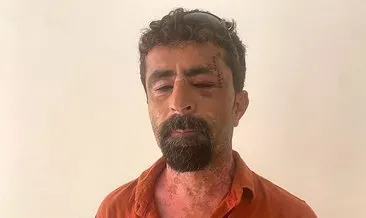 Öfkeli damat, kayınpederini hastanelik etti #antalya