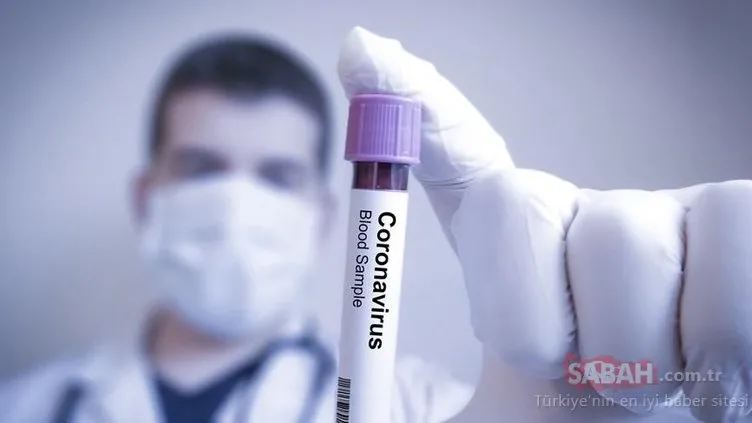 SON DAKİKA HABERİ: Yeni tedbirler alınacak mı? Koronavirüs Bilim Kurulu’nun ardından yazılı açıklama yapıldı!